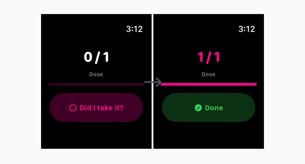 Tap Today on Apple Watch before and after a dose is marked.